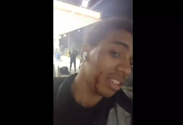 VÍDEO: motoboy diz ter levado tiro no rosto ao fazer entrega em comunidade no Rio