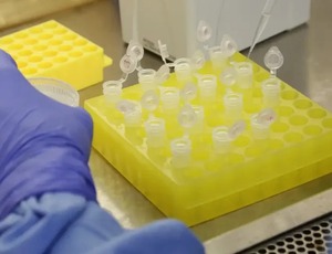 Rio confirma dois casos de sarampo na Baixada Fluminense