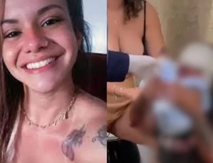 Mulher agredida em elevador passará por cirurgia de reconstrução facial nesta sexta-feira