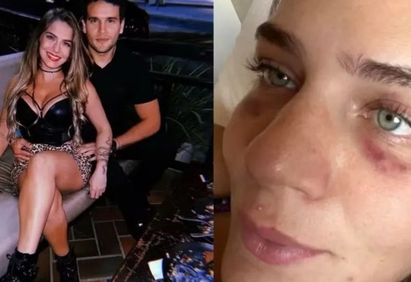 Acusado de agressão, jogador só vai se pronunciar se caso for à Justiça