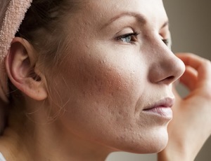 Vitamina C e a Regeneração da Pele: Como Garantir Firmeza, Brilho e Juventude Natural