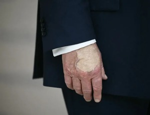 Trump volta a usar maquiagem na mão após diagnóstico