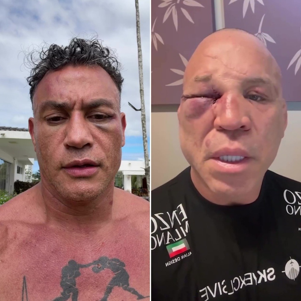 O que disseram Popó e Wanderlei após briga em evento