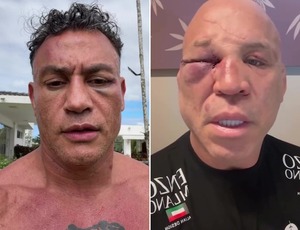 O que disseram Popó e Wanderlei após briga em evento
