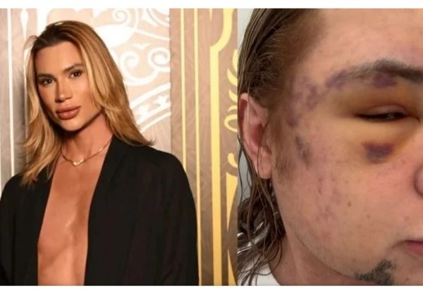 Morte de influenciador após procedimento estético reacende alerta