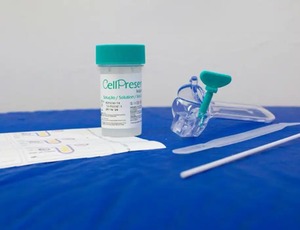 Guia orienta sobre mudança no rastreamento do câncer de colo do útero